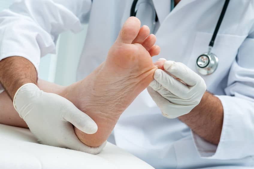 درمان زخم پای دیابتی و مراقبت از پا