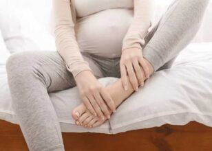 تورم پا در دوران بارداری