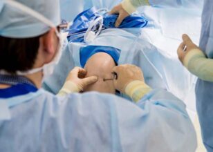 جراحی آرتریت | معرفی انواع جراحی، زمان بهبود و عوارض آن ها